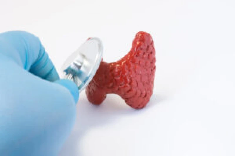 post sobre hipertireoidismo - desvendando